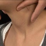 首を吊り上げ絞め喉仏を潰す